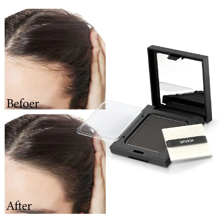 Sevich 4 Colors 12g Hair Shadow Powder Waterproof Hairline Edge Control Powder Root Cover Up Dark Brown Hair Concealer With Puff Eyebrow Powder Hair Growth Powder Hair Care Products