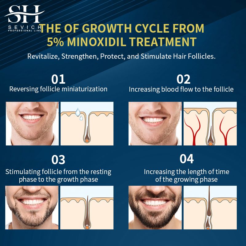 SEVICH 5% Minoxidil Beard Growth Oil 30ml Beard Oil Beard growth essential oil and Hair Growth Essential oil, bald hair treatment oil Men's Beard Growth Essence Nourishing Enhancer Beard Oil Spray