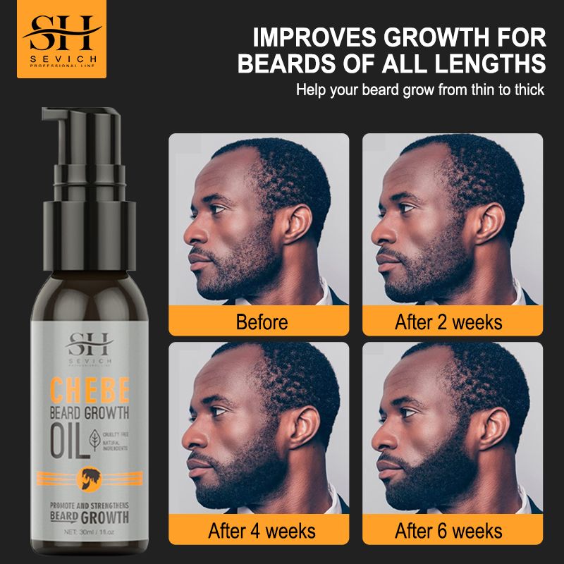 SEVICH Chebe Oil Men's Beard Growth Oil 30ml Beard Growth Essential Oil Bald Hair Treatment Oil Fast Hair Growth Oil Beard Growth Essence Nourishing Enhancer Beard Oil Spray Beard Care