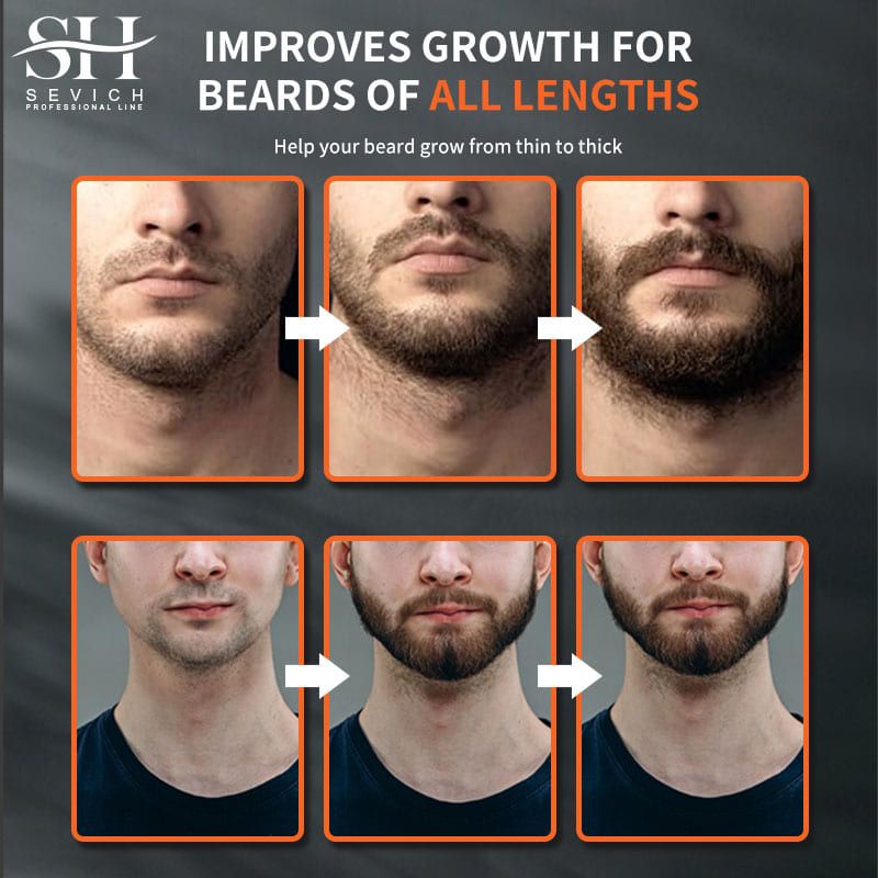 SEVICH Chebe Oil Men's Beard Growth Oil 30ml Beard Growth Essential Oil Bald Hair Treatment Oil Fast Hair Growth Oil Beard Growth Essence Nourishing Enhancer Beard Oil Spray Beard Care