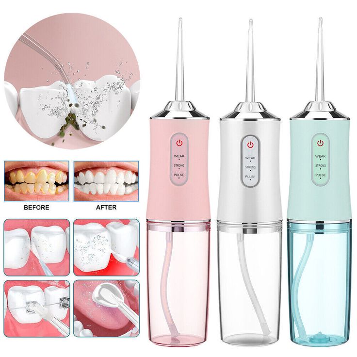 Dental Water Jet Irrigator Dental flosser, 4 nozzles, 1400rpm Teeth Cleaner 3 Modes Oral Hygiene Cleaning Machine 4 heads 4 cleaning options 99.9% cleaning power Ideal for cleaning braces