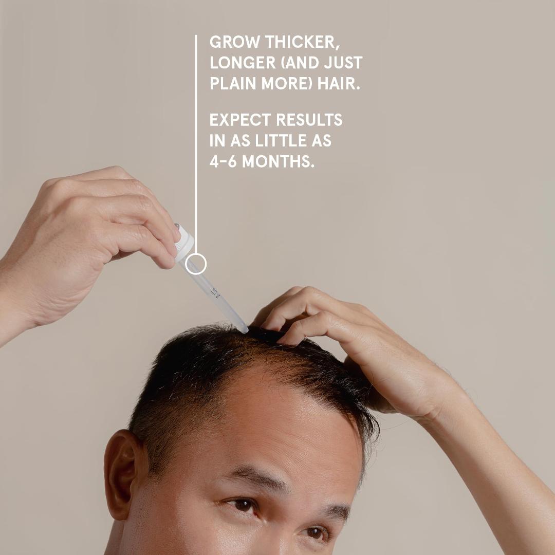 Keeps Extra Strength 5% Topical Minoxidil for Men, Topical Hair Growth Serum, 5% Solution Hair Loss Treatment  - Slows Hair Loss & Promotes Thicker Hair Regrowth. - one month supply.