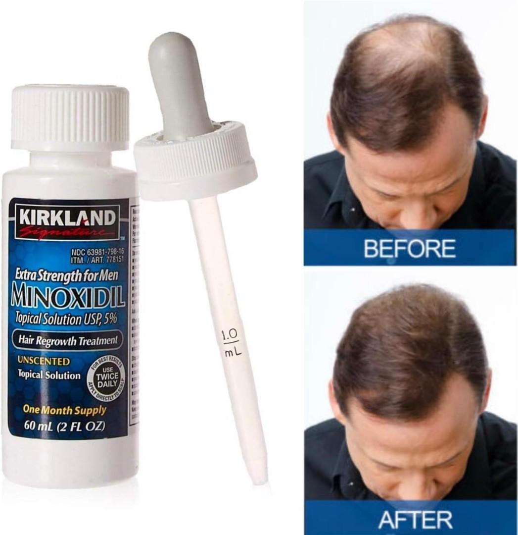 Kirkland Signature Minoxidil 5% Topical Solution for Men. Hair Regrowth Treatment with Dropper.