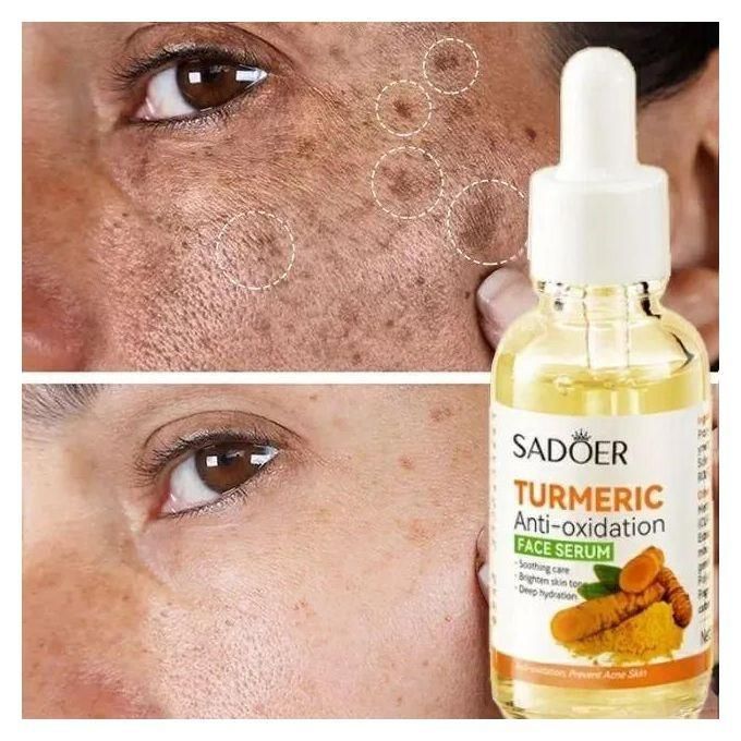 Dark Spot Remover Tumeric Serum, Anti-Oxidation Face Serum Oil Control Acne Remover Even Skin Tones, Improving Skin Tone Brightening Serum - Moisturizing Anti-Aging