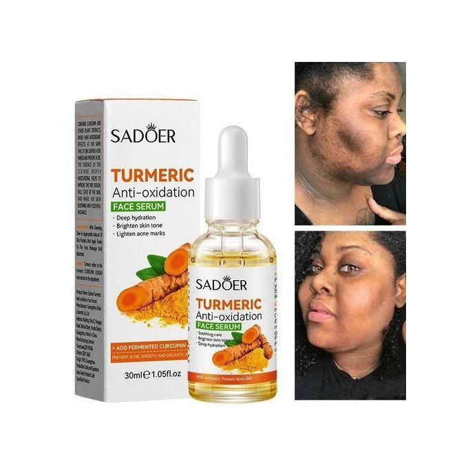 SADOER Dark Spot Corrector Tumeric Serum Dark Spot Remove Acne Pimple Remover Serum