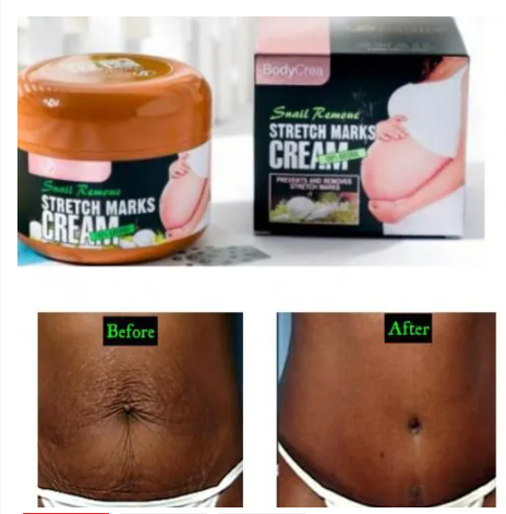 Generic Effective Stretch Marks Snail Cream Anti Stretchmarks Fade