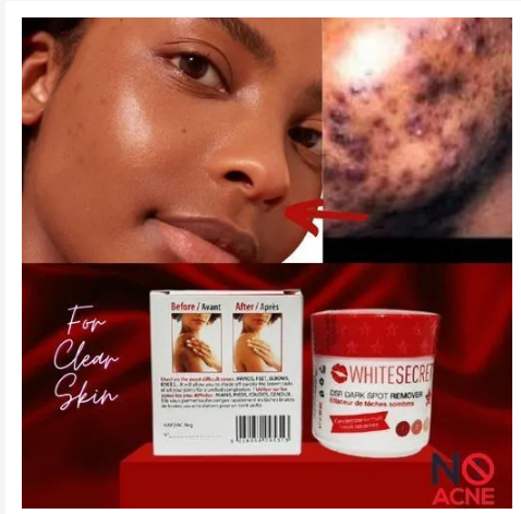 White Secret Dark/Black Spot/Scars Remover/Dark Knuckle,Knees&Elbow-30g.