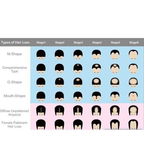 Kirkland Minoxidil 5% extra strength hair loss regrowth system treatment for men Beard care oil premium Topical Solution Growth Nourishing Serum 1 bottle of 60ml  +free derma roller