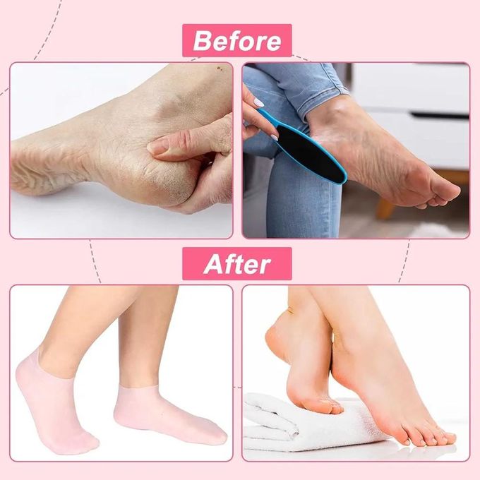 Silicone Socks for Women, Moisturizing Foot Socks, Soft Gel Socks, Aloe Socks, Women Spa Pedicure Socks for Repairing Dry Feet, Cracked Heel and Softening Rough Skin, Calluses-2pcs