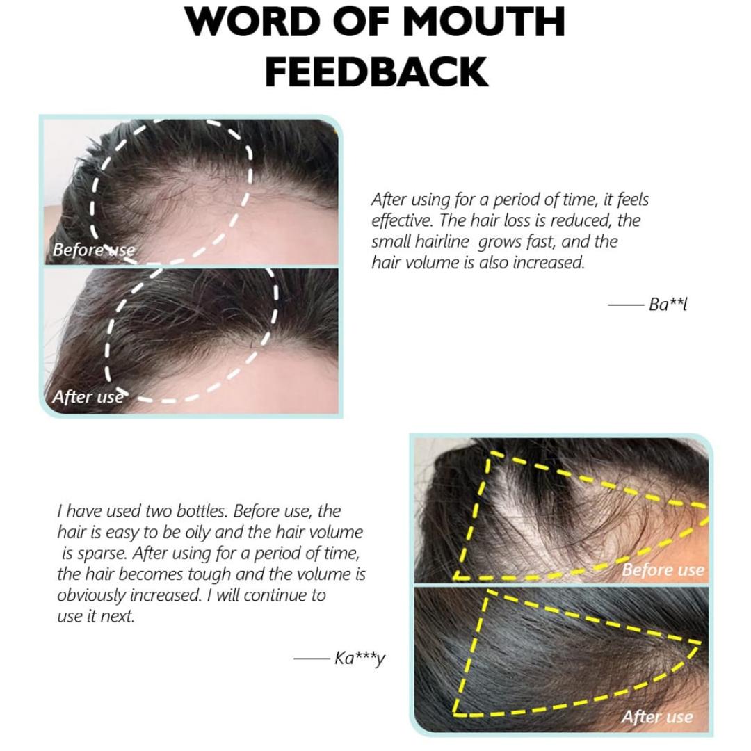 Jaysuing Hair Treatment, Strengthens Hair, Nourishes Root Growth And ThickensOriginal Thailand Hair Lotion Anti-Hair Loss Tonic Hair Treatment Solution 30ml