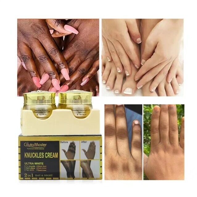 Gluta Master Knuckle Cream Ultra White 2in1 Day & Night for removing Dark Spot ,Knuckle whitening & brightening.