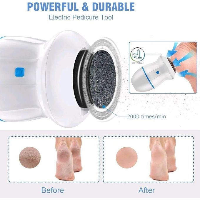 Callus Remover Electric foot scrubber Dead-skin remover Electric foot grinder Electric Callus remover Powerf