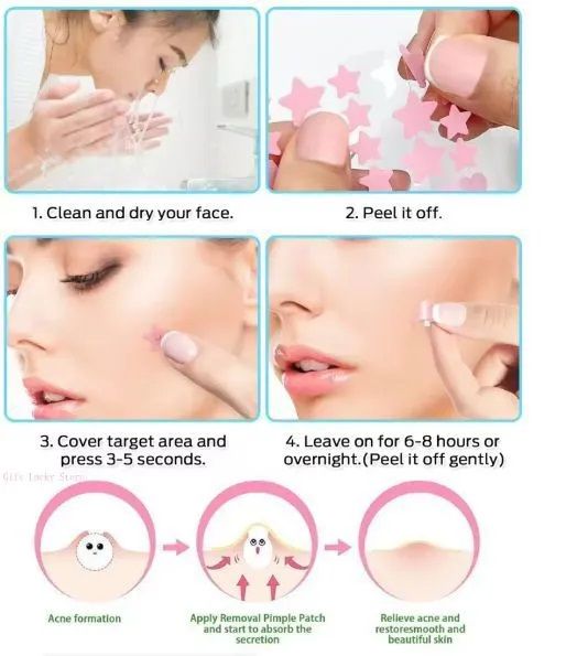 Acne Pimple Patches,Invisible Acne Patch Waterproof Daytime Zit Covers,Absorb Excess Oil & Protect from Picking,Pickel patches, Korean Skin Care Style Acne Cleansing Patch Skin Care Tools -SADOER -