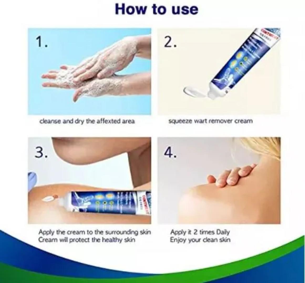 Herbal extract Warts Remover Cream Skin Tag Remover Wart Treatment Cream Moles Foot Corn Antibacterial Warts Cream