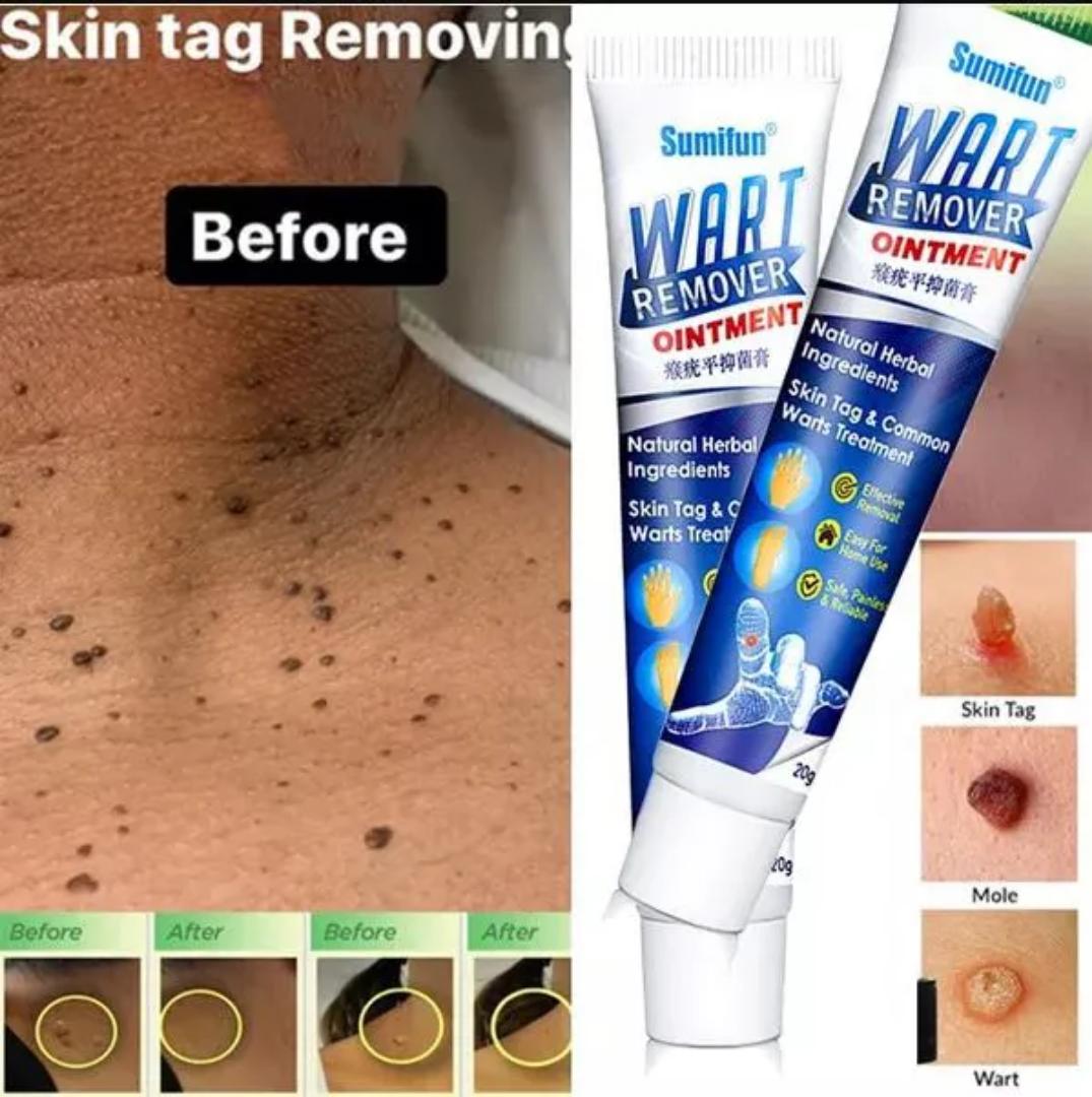 Herbal extract Warts Remover Cream Skin Tag Remover Wart Treatment Cream Moles Foot Corn Antibacterial Warts Cream