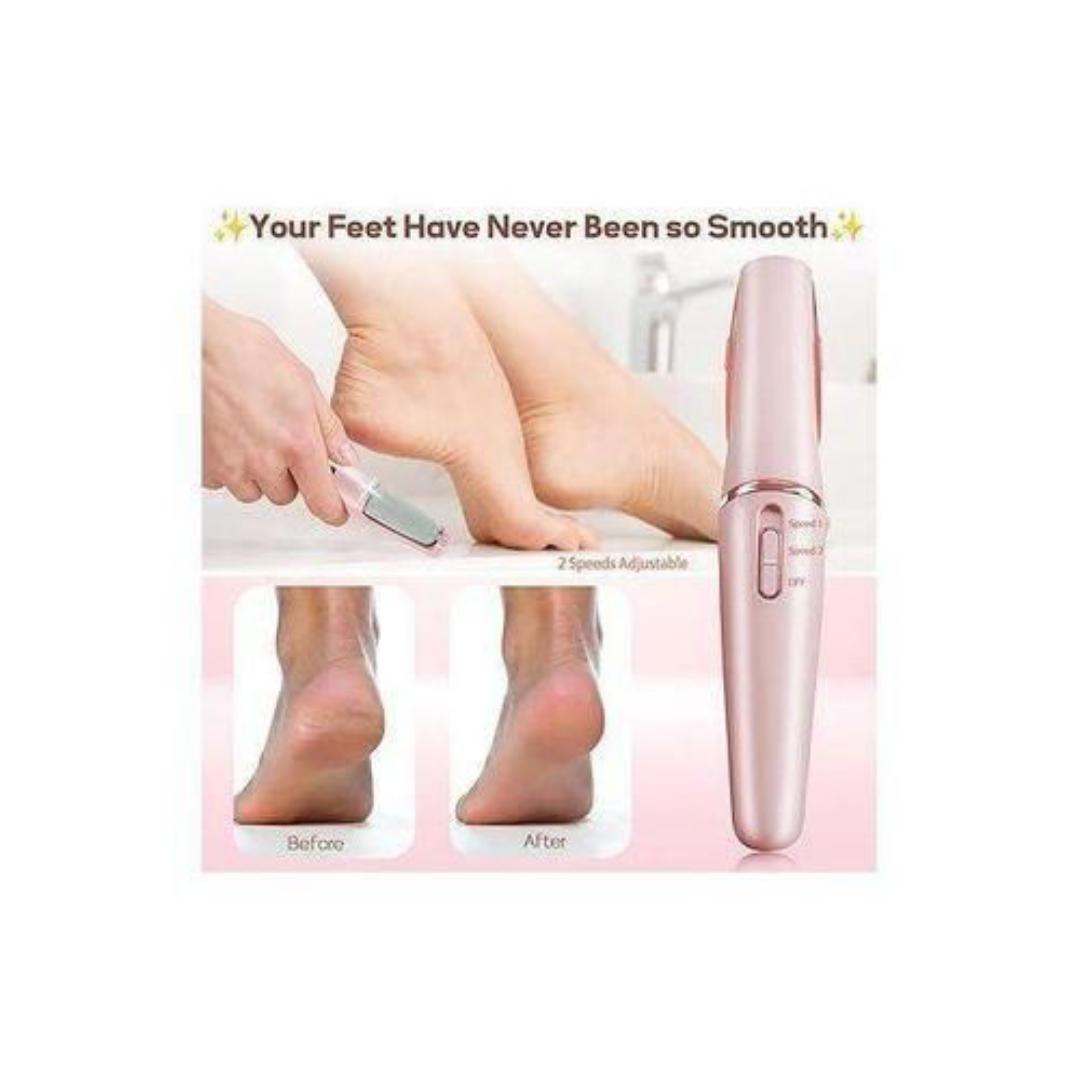 Electric Foot Callus Remover, Pedicure Tools, Pedicure Tool Kit, Foot Care, Rechargeable Pedicure Wand, Remove Dead Skin