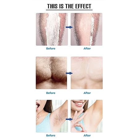Hair Remover, Reusable Hair Removal Without Shaving Crystal Hair Remover Hair Eraser Ladies Wa*➡️Painless Hair Epilashable Nano Hair Removal, Epilator Face Effect Hair Removal Device for Smooth Effect