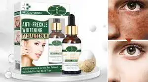 New Arrivals!!Anti freckle whitening facial serum with Nicotinamide and Green Tea Extract 30ml suitable for all skin types