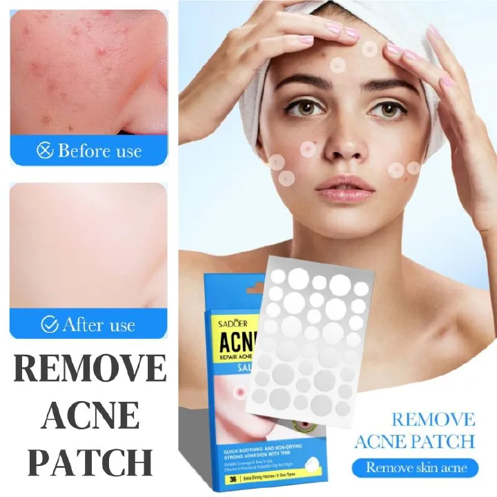 72pcs Acne Patch Acne Skin Care Product Acne Remover Acne Skin Care Acne Treatment Acne Removal Acne Control Cleanser Acne Cleanser Repair Acne Facial Skin Care Remove Acne Patch Remove Skin Acne
