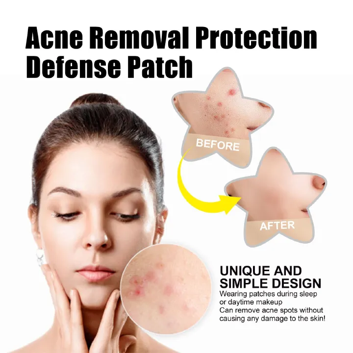 72pcs Acne Patch Acne Skin Care Product Acne Remover Acne Skin Care Acne Treatment Acne Removal Acne Control Cleanser Acne Cleanser Repair Acne Facial Skin Care Remove Acne Patch Remove Skin Acne