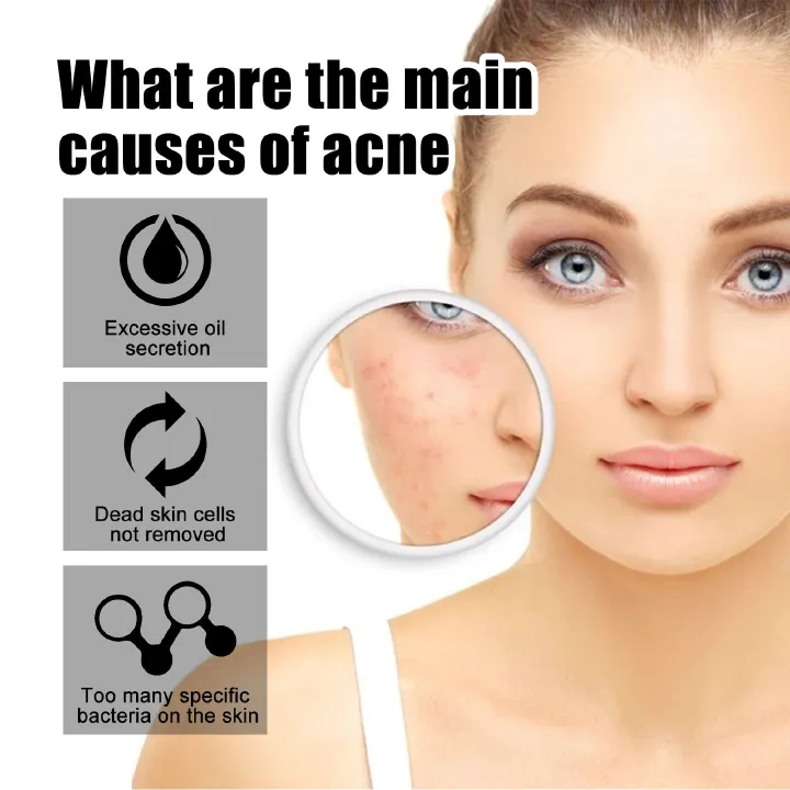 72pcs Acne Patch Acne Skin Care Product Acne Remover Acne Skin Care Acne Treatment Acne Removal Acne Control Cleanser Acne Cleanser Repair Acne Facial Skin Care Remove Acne Patch Remove Skin Acne