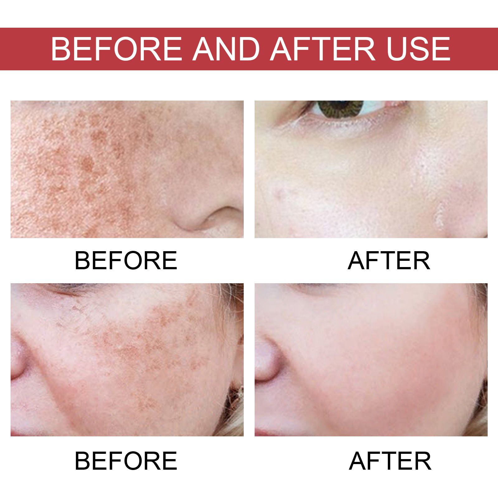 Natural Plants Serum - Skin Care - Moisturize Hydrating Brightening Whitening Acne Treatment | Firming Anti-wrinkle Deeply Nourish Smooth Anti-dark Repair Skin | Salicylic Acid Niacinamide
