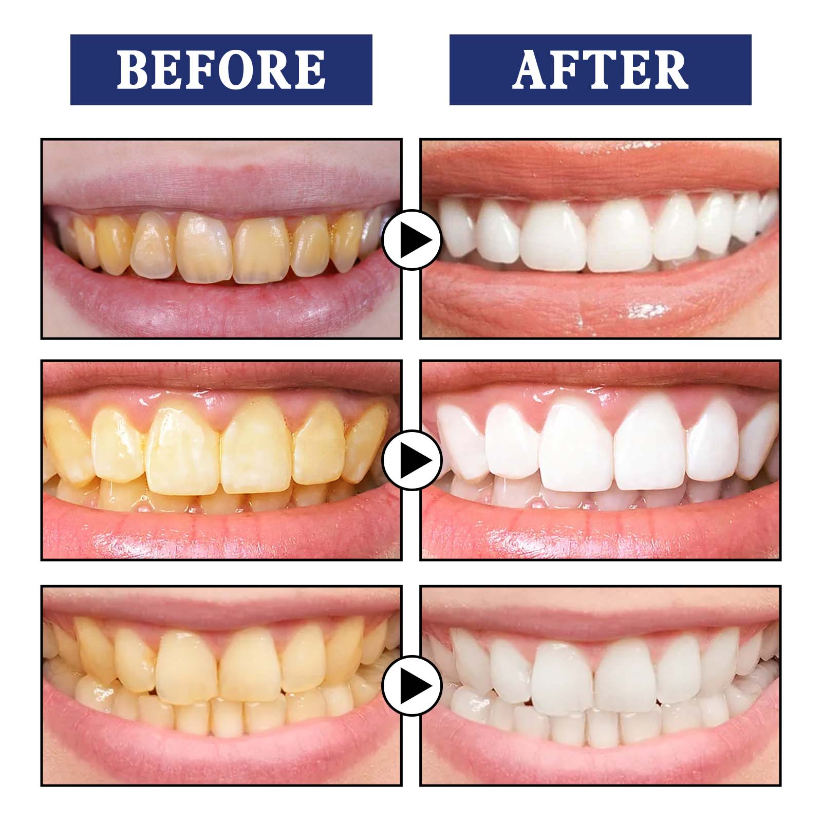 Teeth Whitening Teeth Cleaning Mousse Mouthwash Toothpaste Remove Tartar Oral Health Stain Removal Freshen Breath Remove Plaque Stains Oral Odor Bright and tartar remover