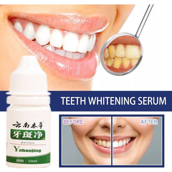 Teeth Whitening Teeth Cleaning Mousse Mouthwash Toothpaste Remove Tartar Oral Health Stain Removal Freshen Breath Remove Plaque Stains Oral Odor Bright and tartar remover