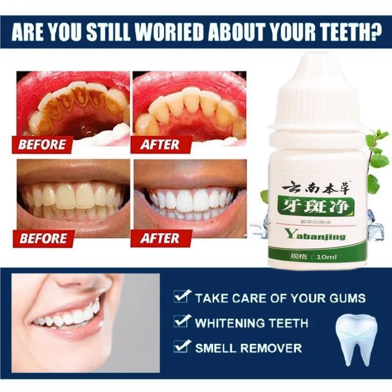 Teeth Whitening Teeth Cleaning Mousse Mouthwash Toothpaste Remove Tartar Oral Health Stain Removal Freshen Breath Remove Plaque Stains Oral Odor Bright and tartar remover