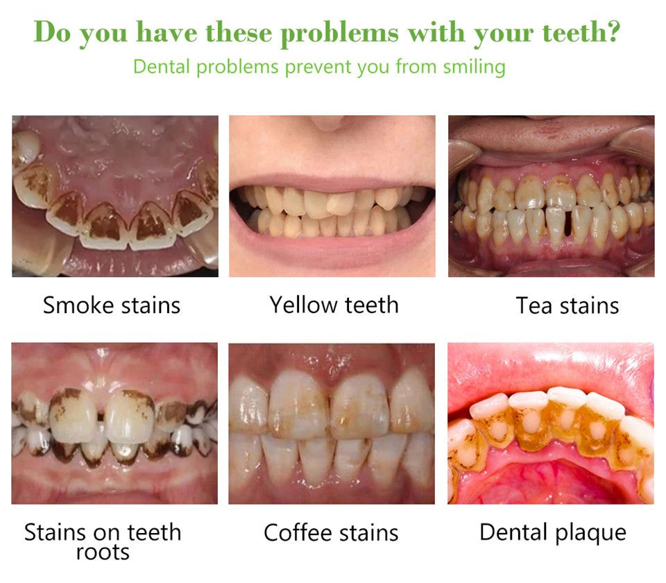 Teeth Whitening Teeth Cleaning Mousse Mouthwash Toothpaste Remove Tartar Oral Health Stain Removal Freshen Breath Remove Plaque Stains Oral Odor Bright and tartar remover