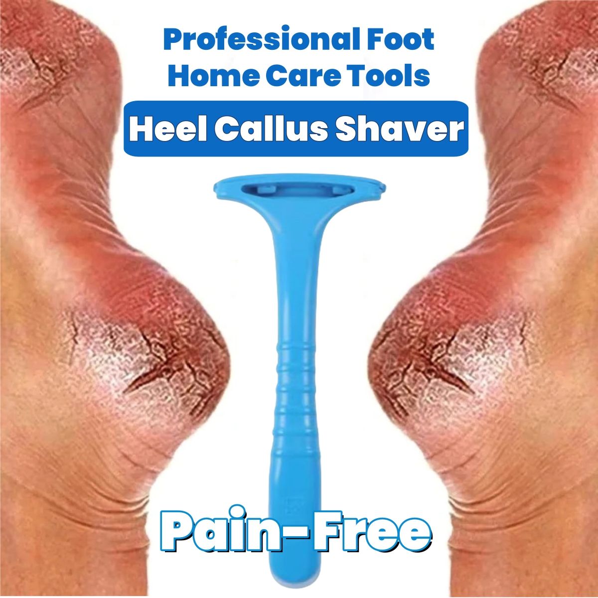 Foot Heel Callus Shaver Home Feet Callosity Razor Dead Skin Shaver Heel Scraper Foot Repair Tools Hard Skin Shaver Foot Care Tool Foot Skin Care Excoliates Cracked Heels Dead Skin Pain Free