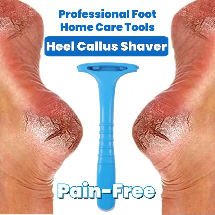Foot Heel Callus Shaver Home Feet Callosity Razor Dead Skin Shaver Heel Scraper Foot Repair Tools Hard Skin Shaver Foot Care Tool Foot Skin Care Excoliates Cracked Heels Dead Skin Pain Free