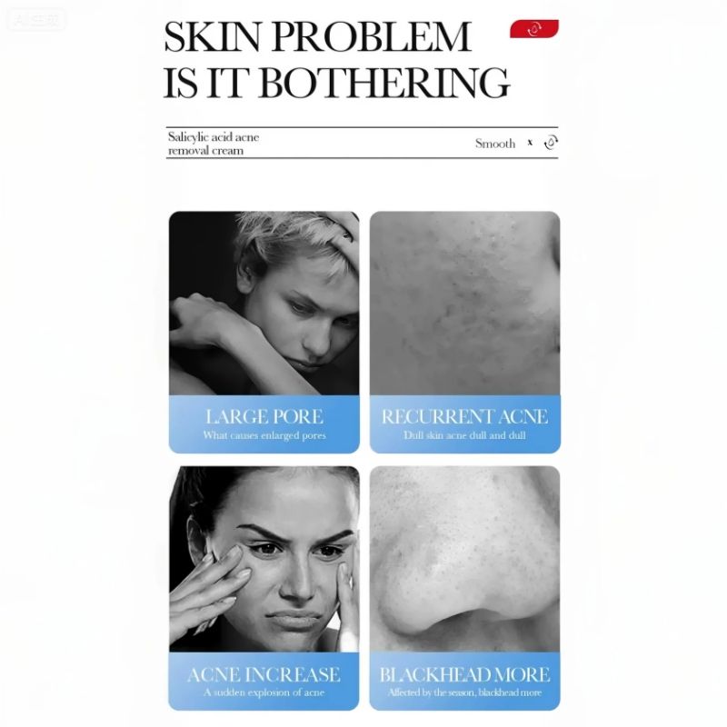 BIOAOUA Skin Care Set Salicylic Acid Acne Removal Cream Treats Pimples Remove Acne Dark Spots Shrinks Pores Oil-Free Budget-Friendly Fade Acne Marks Get Rid Acne Shrink Pores Soothes Redness