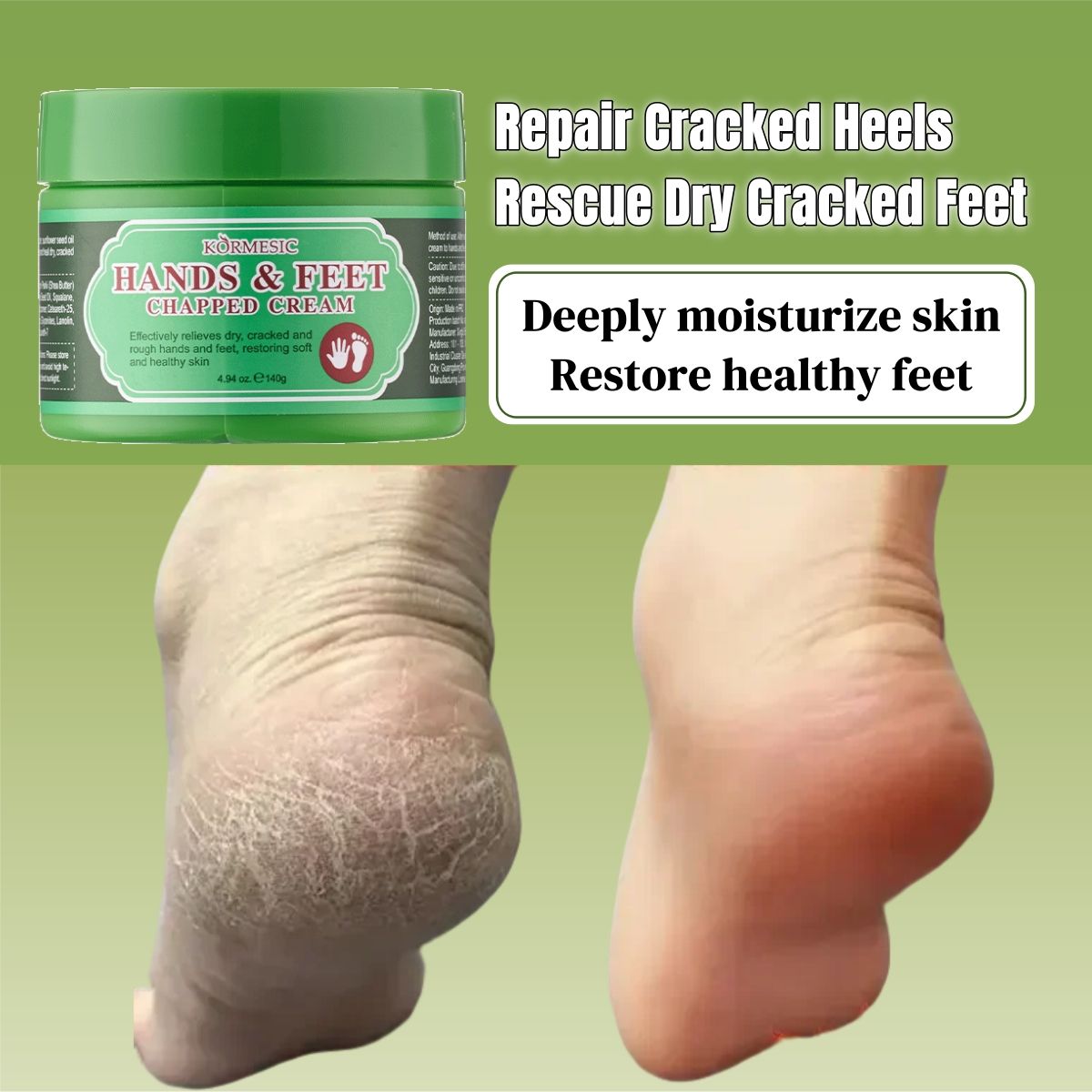 KORMESIC Hands & Feet Chapped Cream Repair Cracked Heels Dry Cracked Feet Rescue Foot Cracks Split Heels Hard Skin & Cracks Heel Fissures Plantar Rhagades Painless Deep Skin Fissures Moisturizer 140g