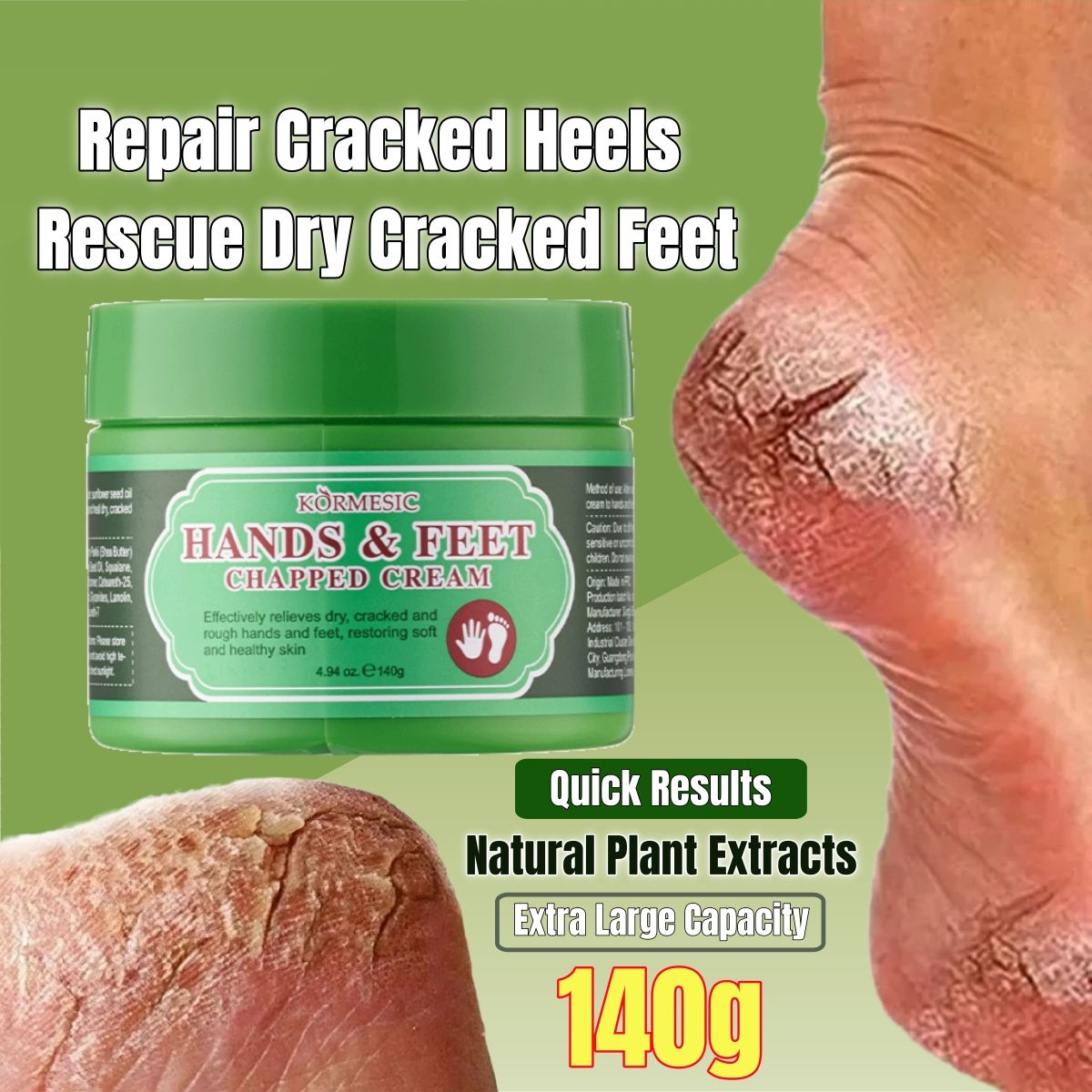 KORMESIC Hands & Feet Chapped Cream Repair Cracked Heels Dry Cracked Feet Rescue Foot Cracks Split Heels Hard Skin & Cracks Heel Fissures Plantar Rhagades Painless Deep Skin Fissures Moisturizer 140g