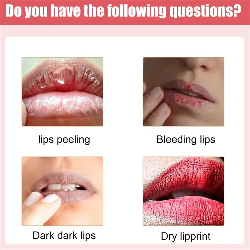 Lips Pink Cream Fresh Bleaching Treatment Remove Dark Smoke Lips Lip Balm Whitening Moisturizer Nourish Essence Dilute Melanin B2-916