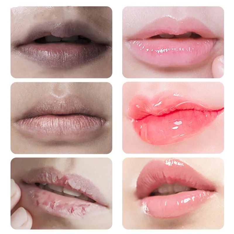 Lips Pink Cream Fresh Bleaching Treatment Remove Dark Smoke Lips Lip Balm Whitening Moisturizer Nourish Essence Dilute Melanin B2-916