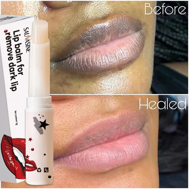 Lip Balm For Remove Dark Lip Moisturizing Lightening Melanin Whitening Plumper Extreme Gloss Pink Lips Skin Care For Men Women B2-839