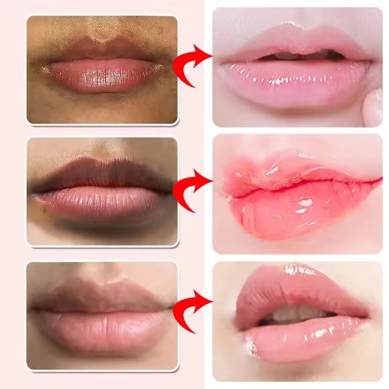Lip Balm For Remove Dark Lip Moisturizing Lightening Melanin Whitening Plumper Extreme Gloss Pink Lips Skin Care For Men Women B2-839