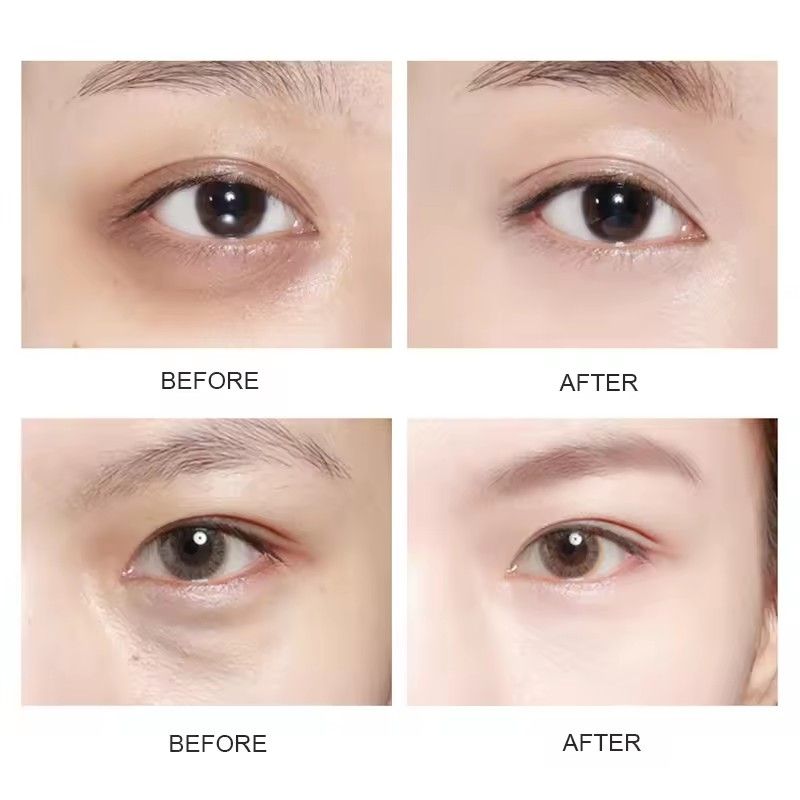 5Pairs Crystal Gold Eye Patches Anti Dark Circles Remove Eye Bags Moisturizing Golden Collagen Eye Mask Skin Care Eyes B2--107