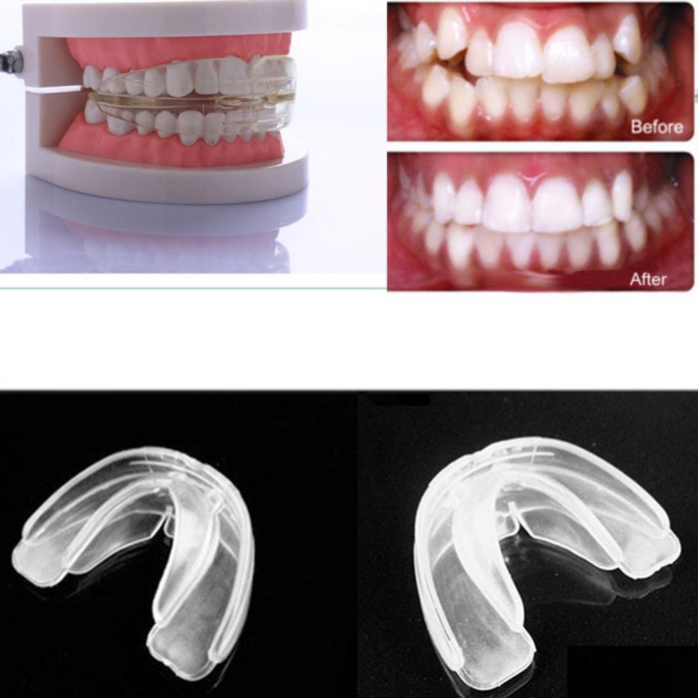 Teens Adult Health Care Straight Teeth System Orthodontic Anti-Molar Retainer cosmetic orthodontics cheapest braces B2---40