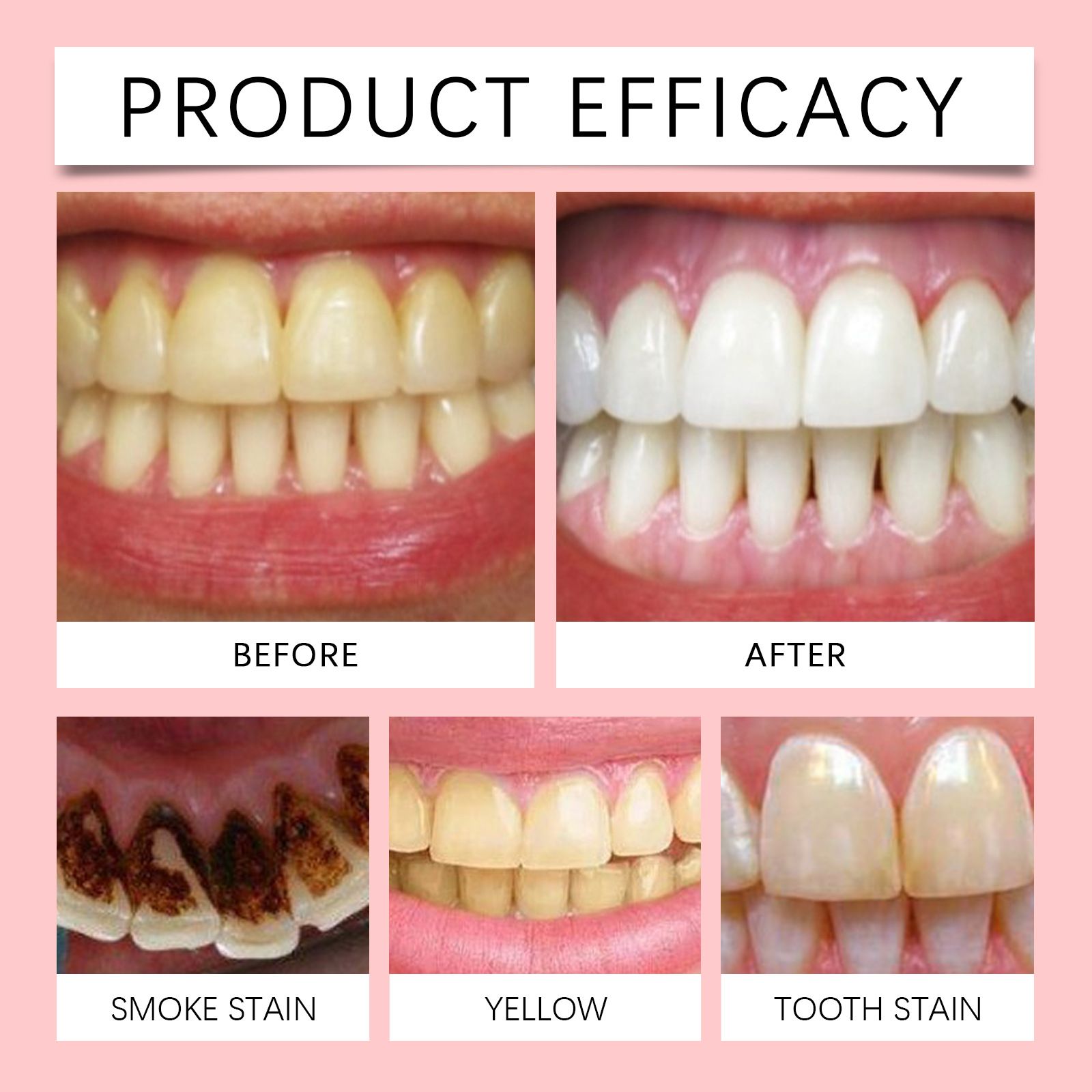 Sp10 Probiotic Toothpaste Tooth Brightening Remove Plaque Improve Dental Caries Protect Gum Fresh Breath Oral Hygiene Cleansing Sp-10