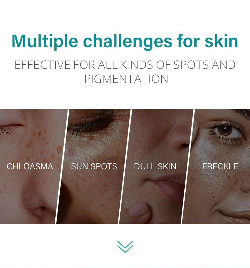 1PC DARK SPOT REMOVAL CREAM  WHITENING FRECKLE CREAM