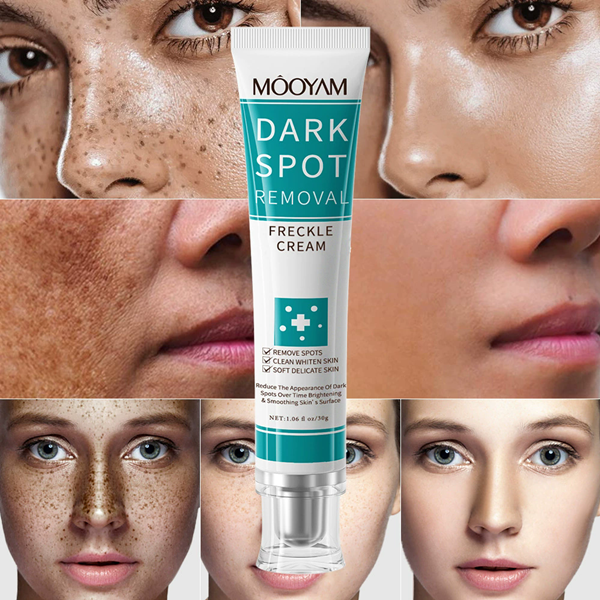 1PC DARK SPOT REMOVAL CREAM  WHITENING FRECKLE CREAM
