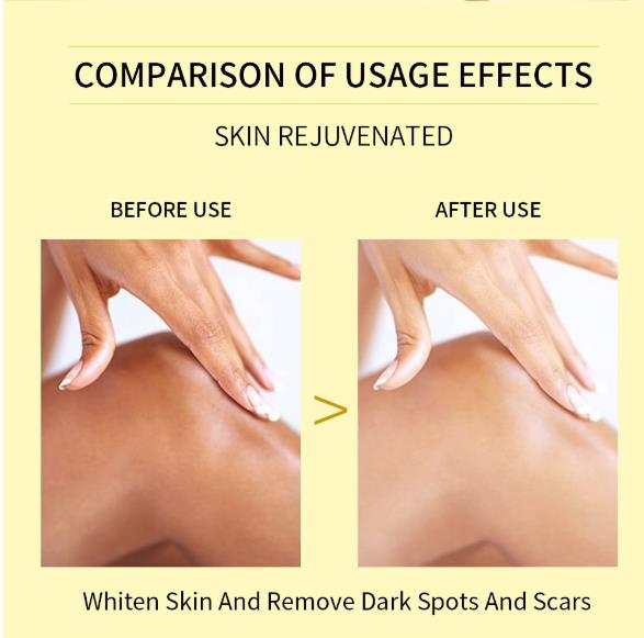 1PC  Tender and Whitening Peeling Oil, Hand, Foot, Face, Whole Body Care Moisturizing Oil