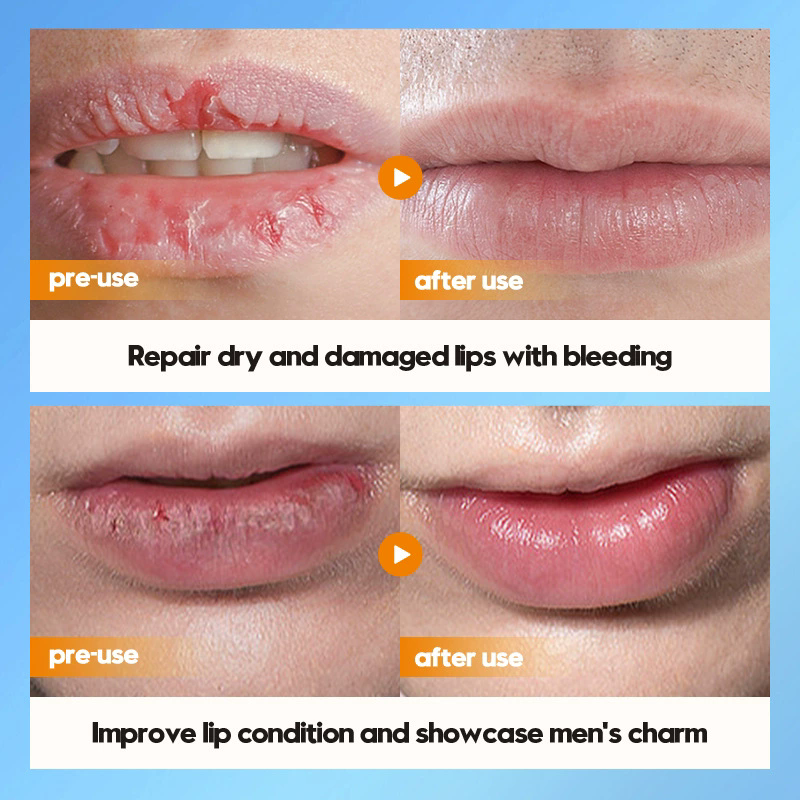 1PC   SADOER Men's Lip Balm Moisturizing Anti Cracking Repair Nourishing Hydrating Lipstick Men Lips Skin Care ProductsB2-1056