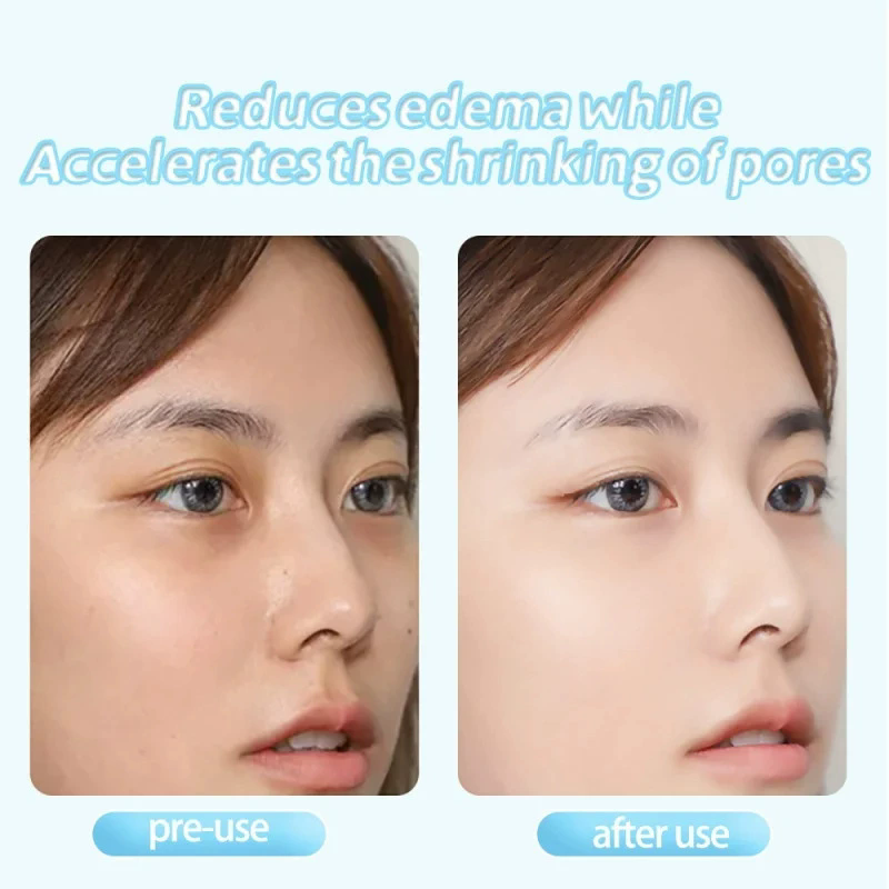 Ice Compress Roller Reusable Improve Elasticity Reduce Pain Cold Handheld Facial Massager White Puffiness Relief Skin Firming