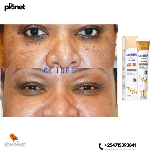 Collagen Revive Eye Cream
Anti-Aging Eye Repair Treatment
Deep Hydration Eye Moisturizer
Wrinkle-Fade Eye Gel for Dry Skin
Youthful Glow Collagen Eye Cream
Collagen Anti-Wrinkle Eye Cream