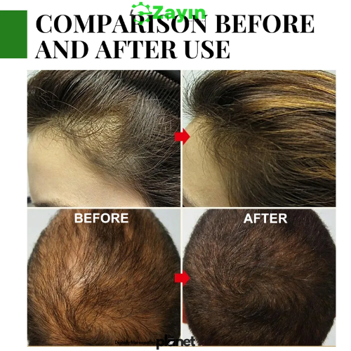 Dess Rosemary Oil Strengthening Hair Serum – 60ml | Stimulates Growth, Reduces Hair Loss, Nourishes Scalp
Dess Rosemary Hair Growth Oil
Dess Hair Serum for Hair Loss
Natural Rosemary Oil for Hair