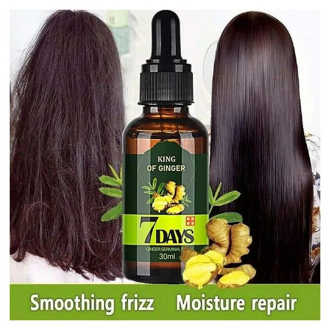 King Of Ginger 7 Days Ginger Germinal Oil Hair Growth Repair Nourish Root Nutrition Care - Aichun Beauty